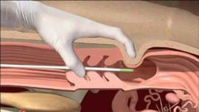 নাইট্রোজেন ট্যাংক কাহিনী