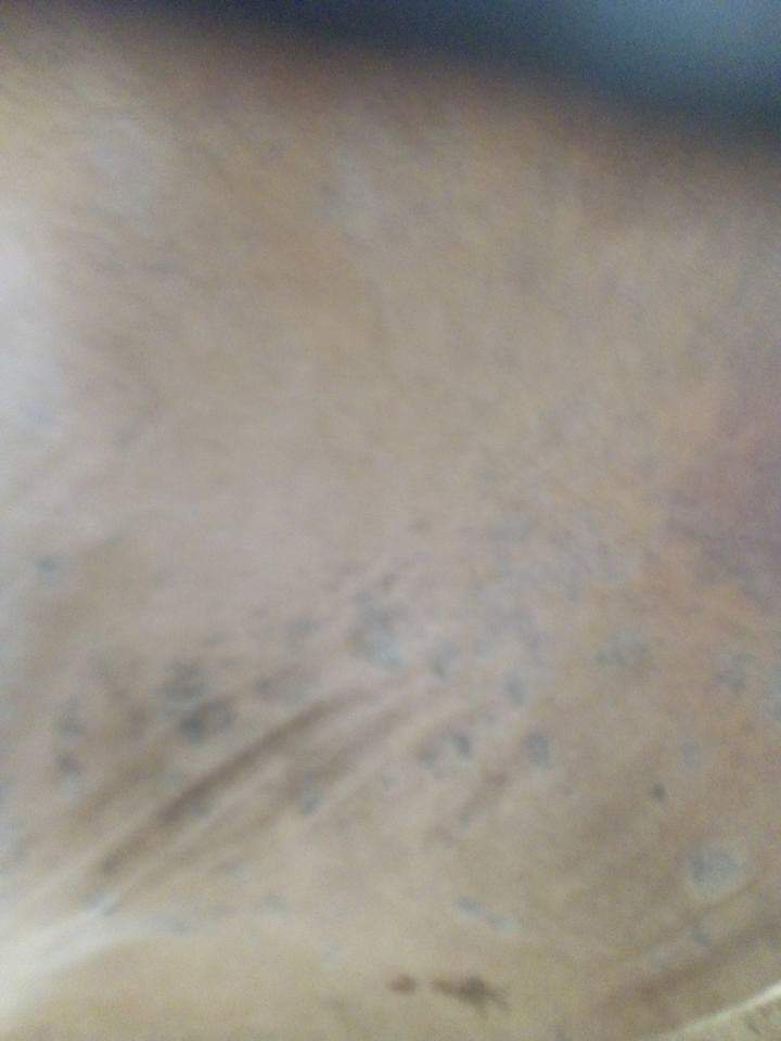 চর্মরোগ